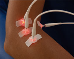 Laser Needle on arm